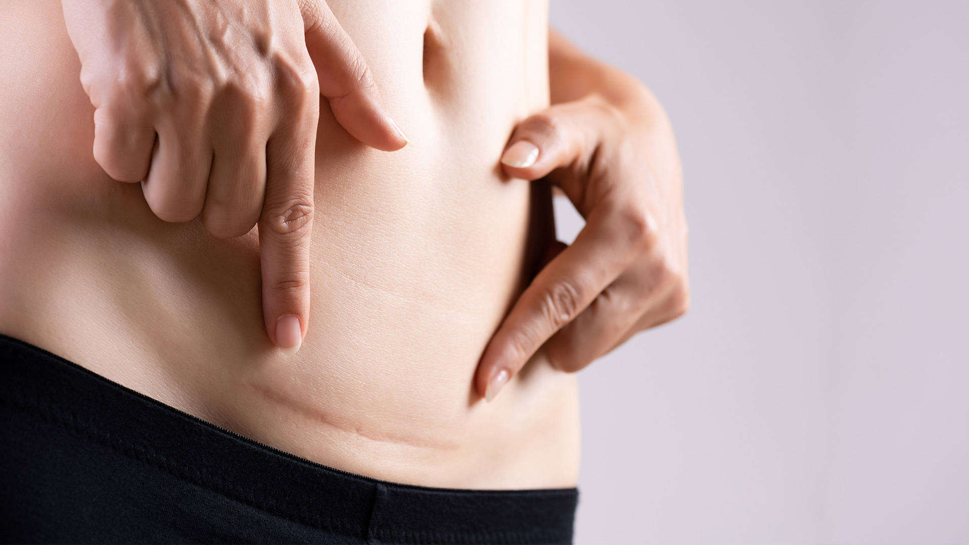 Perinoplasti (Perine Estetiği)